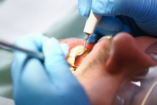 Best Pediatric Emergency Dentist in Athens, OH
