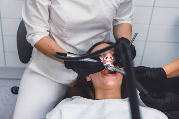 Best Emergency Wisdom Teeth Removal in Athens, OH